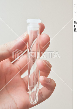 尿検査の入れる容器 健診用採尿セット - 検尿 ‐ 採尿 株式会社アトレータ