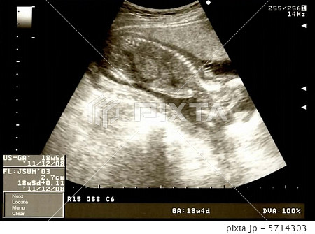 妊娠8週 8週 エコーの写真素材