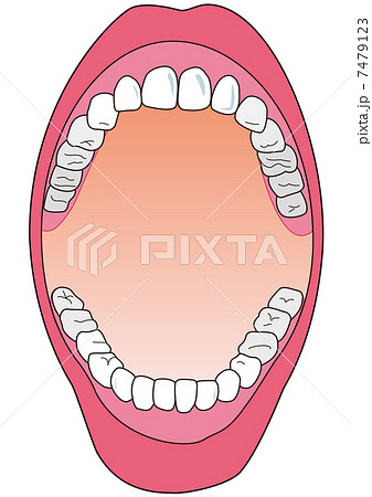 口を開ける 虫歯 歯のイラスト素材