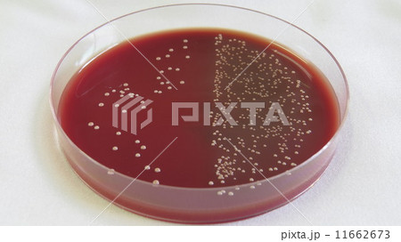 血液寒天培地 乳酸菌の写真素材