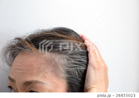 白髪 老化 悩む おでこの写真素材