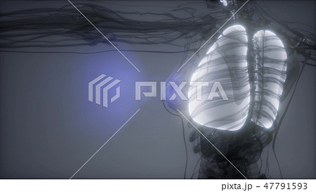 胸部 レントゲン 女性 胸の写真素材 - PIXTA