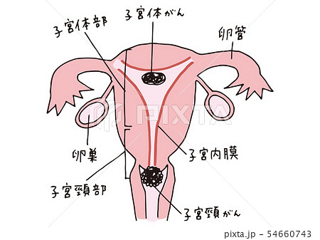 子宮ガン 文字あり のイラスト素材