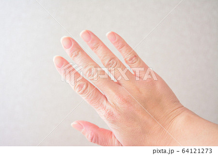 肌割れの写真素材