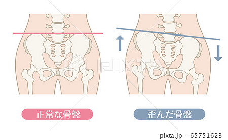 歪みのイラスト素材