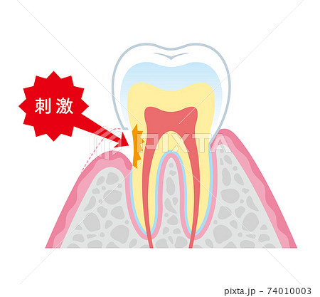 歯周病のイラスト素材