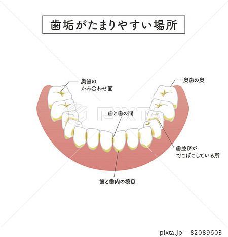 犬歯のイラスト素材