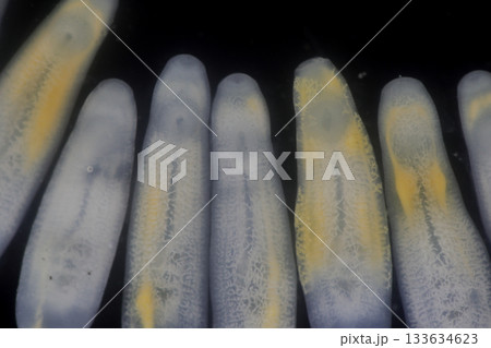 サナダムシの写真素材 - PIXTA